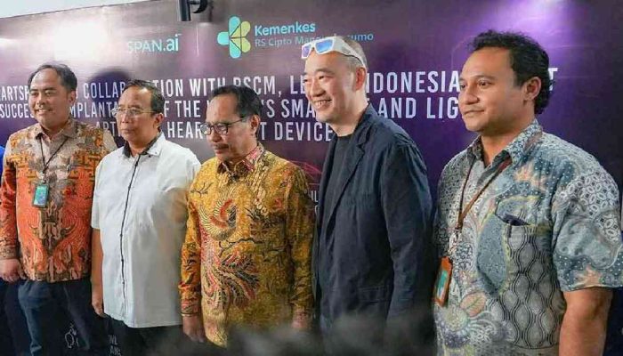 RSCM dan HeartSpan.ai Wujudkan Implantasi LVAD Pertama di Asia
